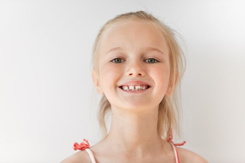 علل فاصله دندان ها در کودکان