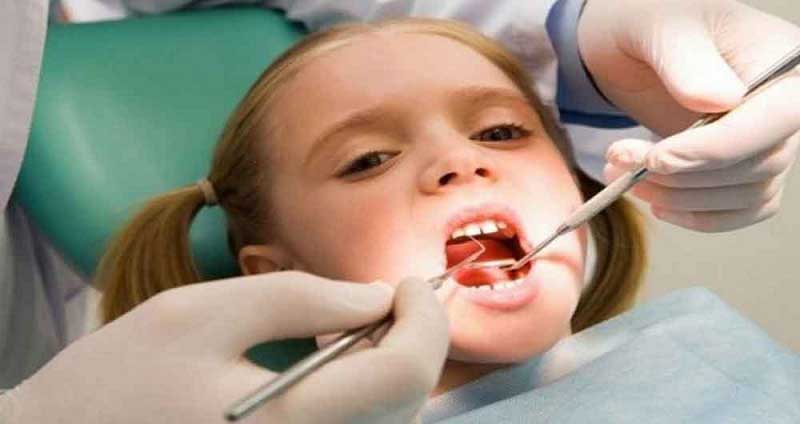 بهترین دکتر برای عصب کشی دندان شیری کودک