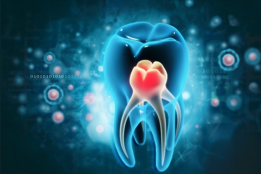 چه زمانی نیاز به عصب کشی دندان وجود دارد؟