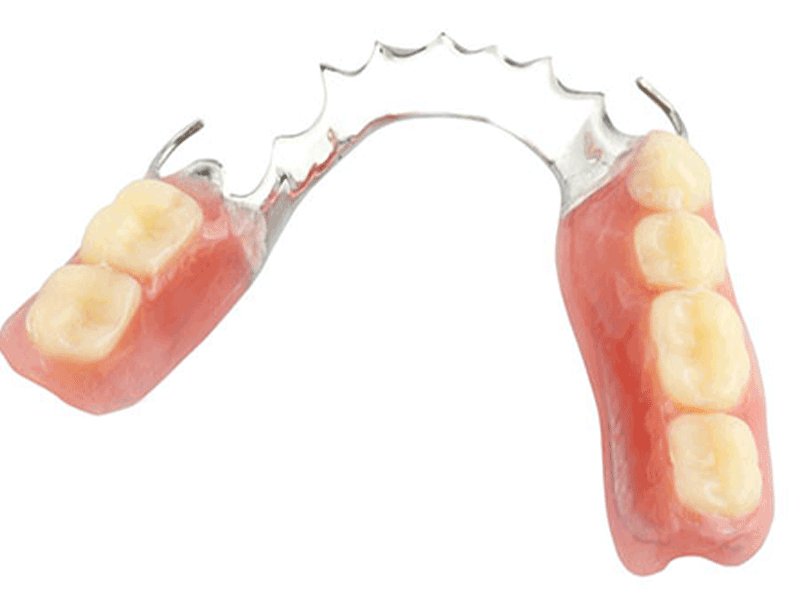دندان مصنوعی ژله‌ای بهتر است یا معمولی