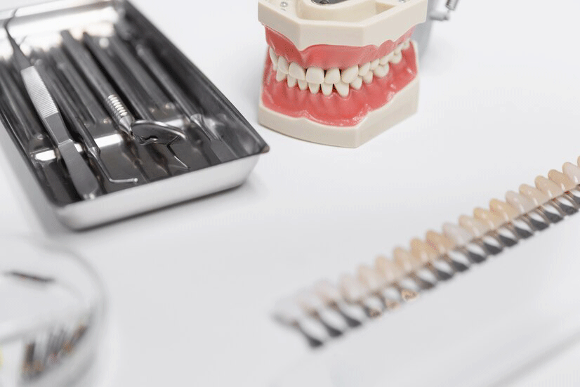 لمینت دندان چیست ؟