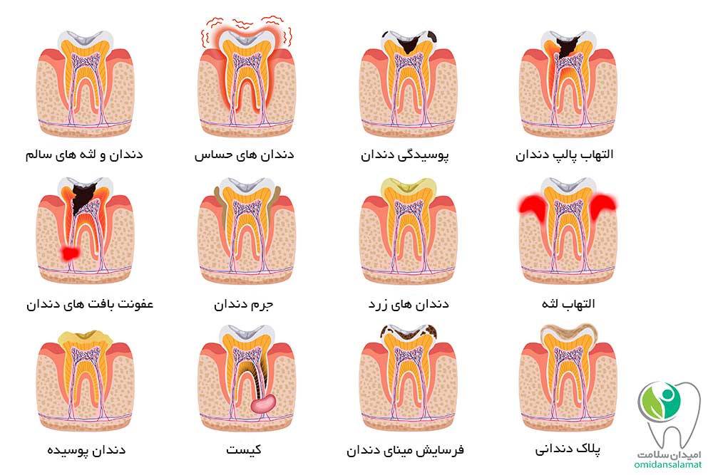 کاهش هزینه های خدمات دندانپزشکی با کارت تخفیف امیدان سلامت 